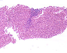 Trichrome overview