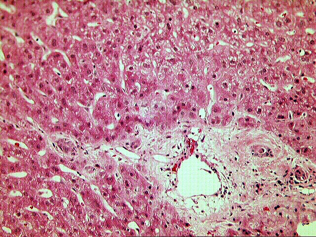 Microscopic Description - Case 18